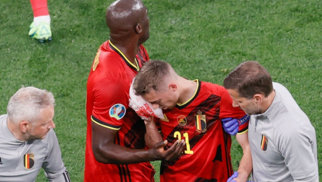Еуро-2020 матчінде Бельгия құрамасының қорғаушысы көз шарасы сүйегін екі жерден сындырған